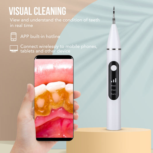 Dental Tartar & Calculus Removal with HD Camera