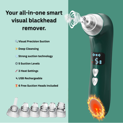 Heated Blackhead Remover with HD Camera