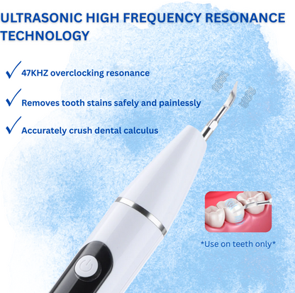 Dental Tartar & Calculus Removal with HD Camera